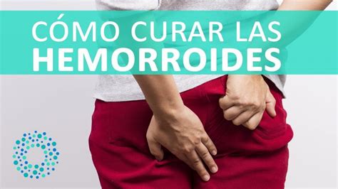 Hemorroides externas e internas: qué son y tratamientos 